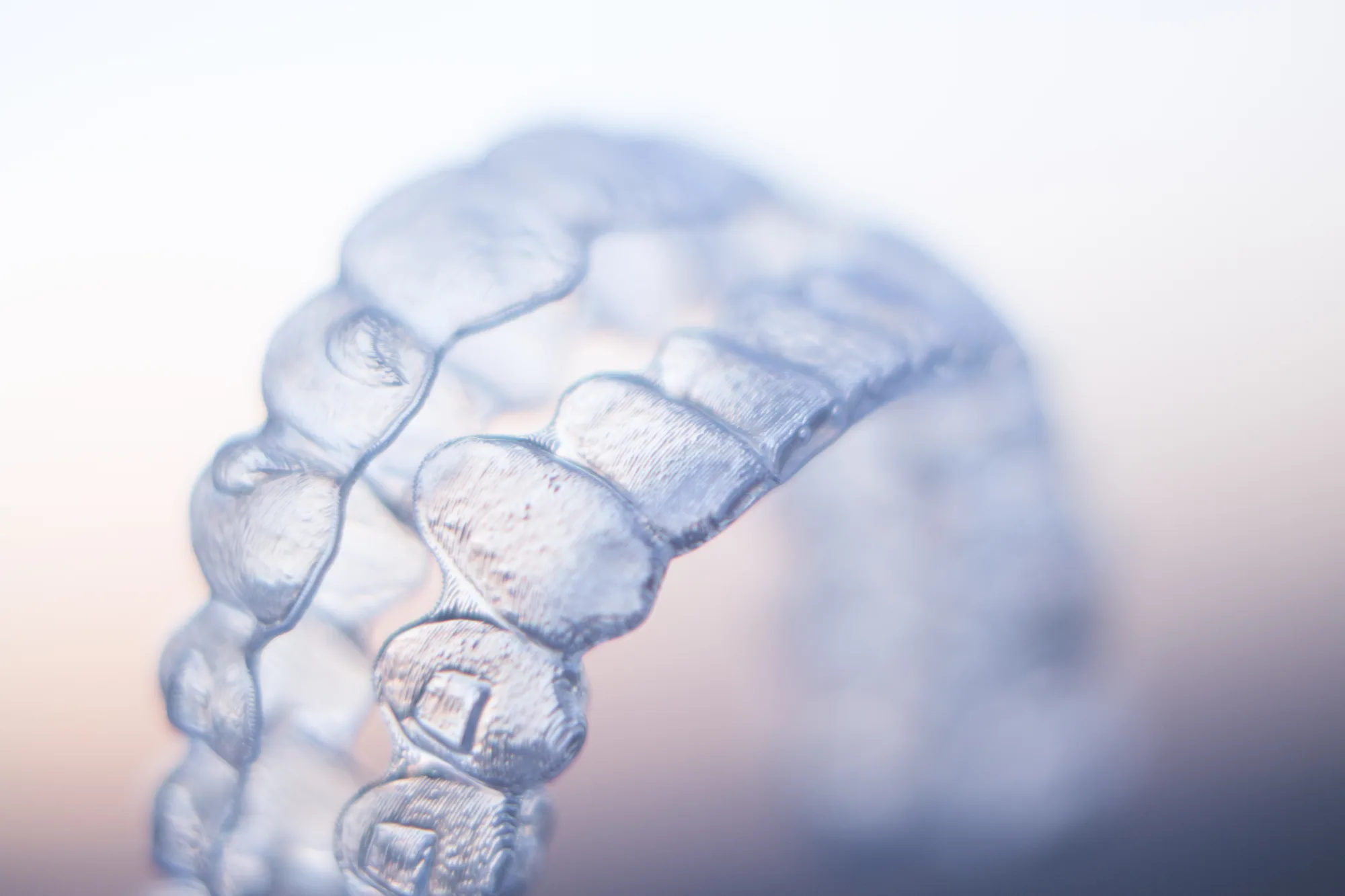 Voor wie zijn aligners geschikt?