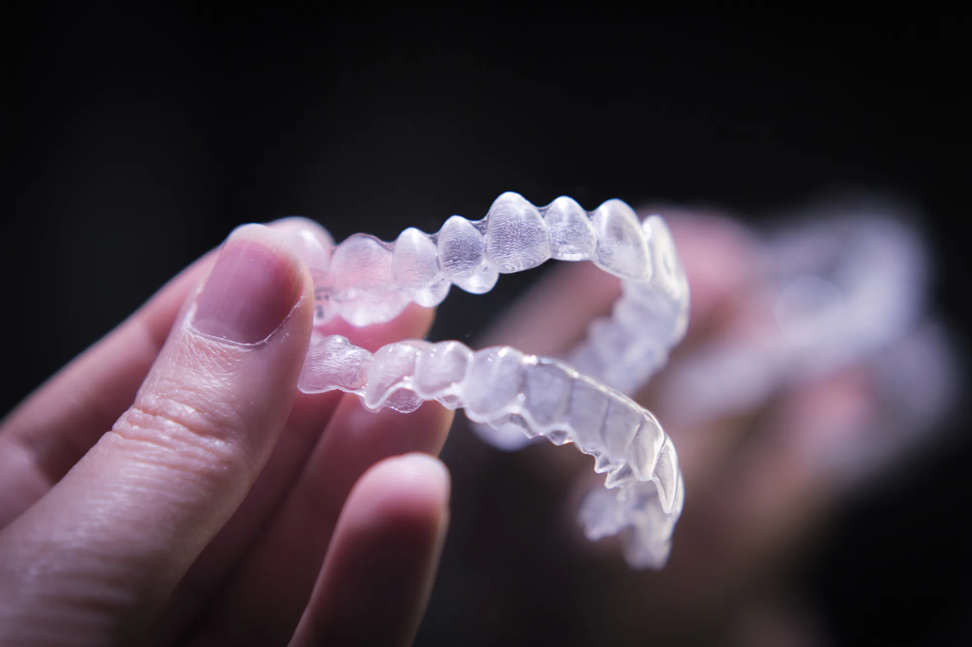 Aligners without an orthodontist: what are the risks?
