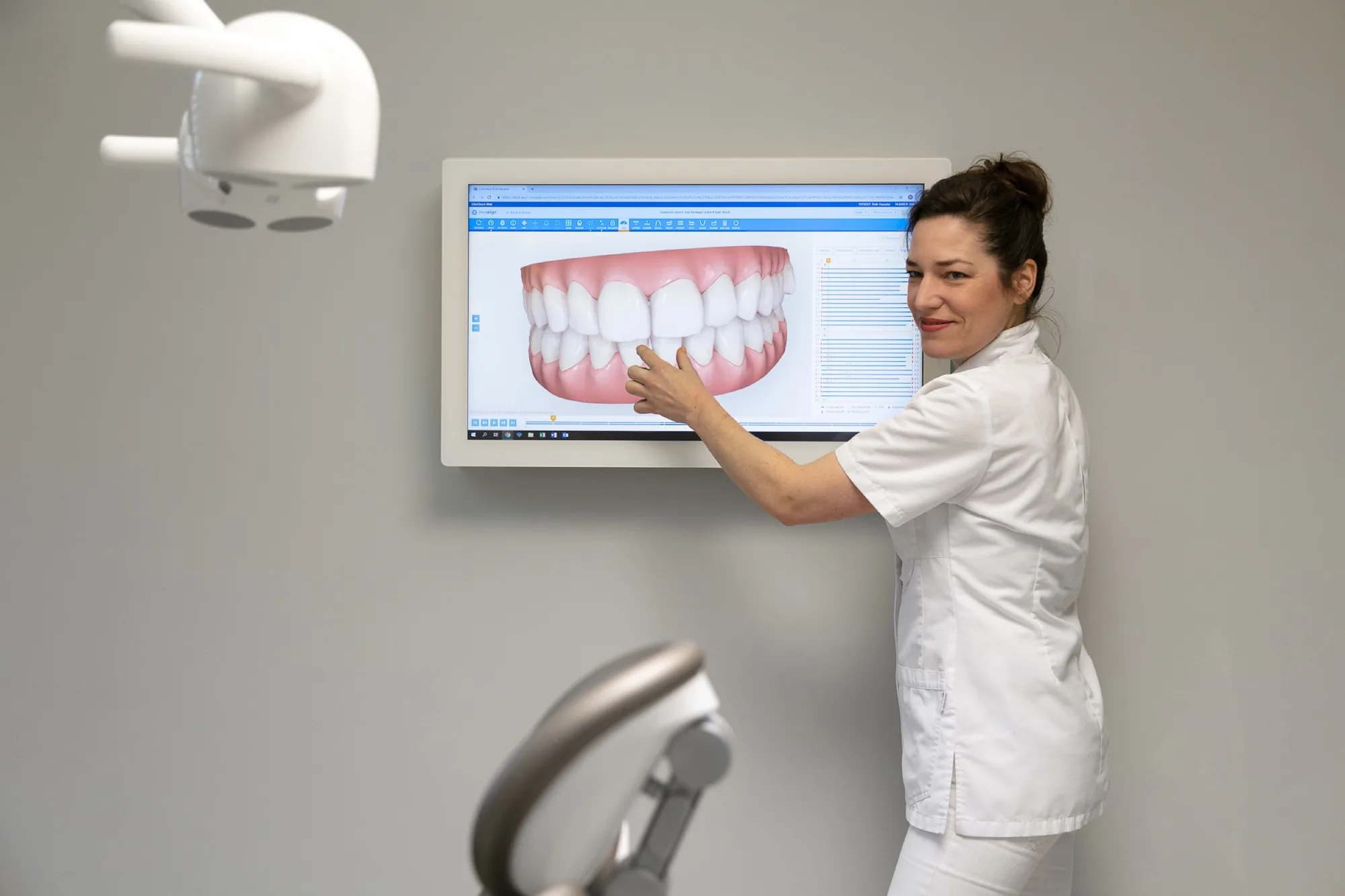 Aligners van Invisalign